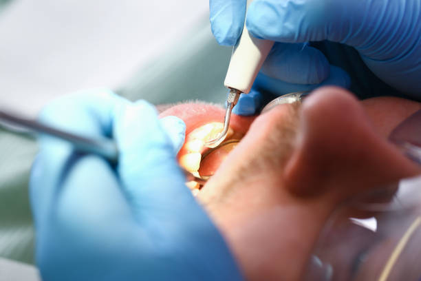 Best Tooth Infection Emergency Dentist  in Lula, GA