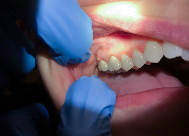 Best Dentist for Dental Trauma  in Lula, GA